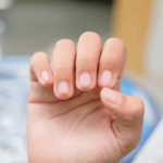 Where do you notice nail changes most?