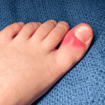 Where do you notice nail changes most?