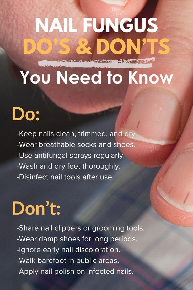 Nail Fungus Do’s & Don’ts You Need to Know