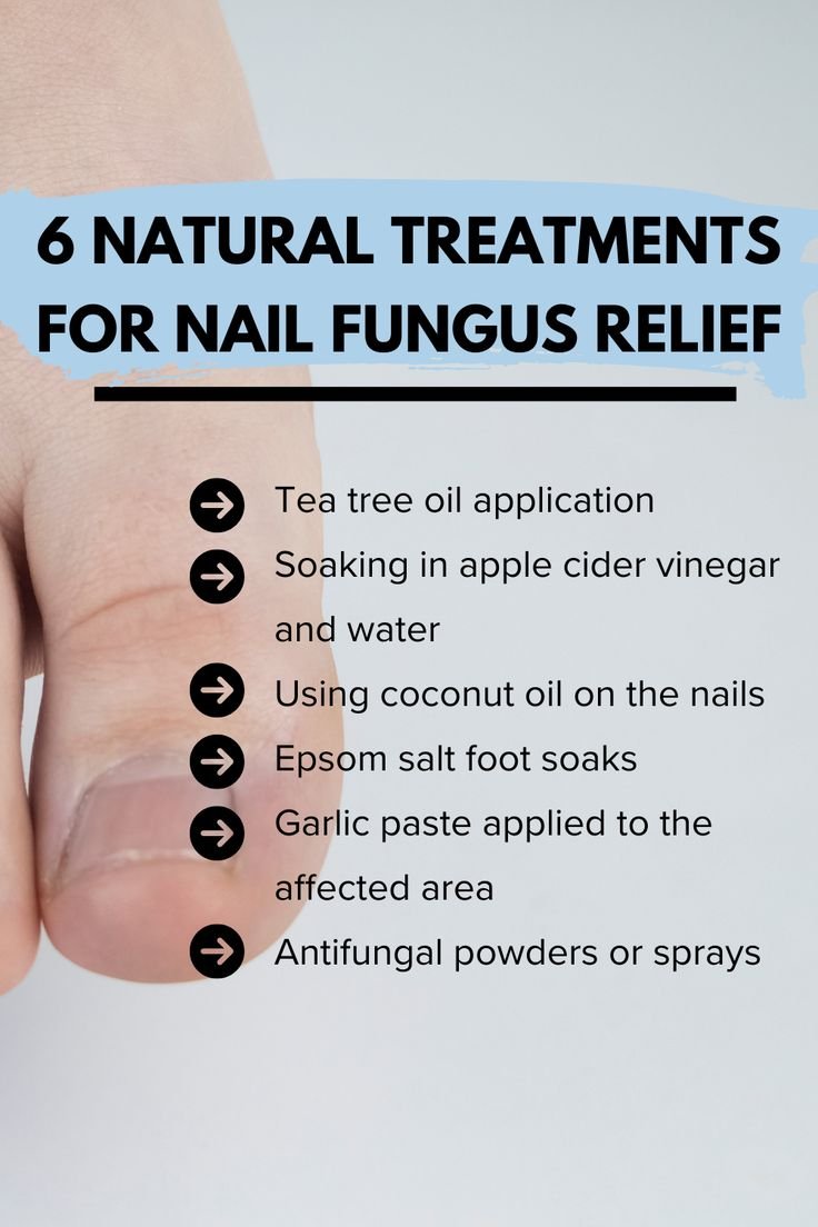 6 Natural Treatments for Nail Fungus Relief