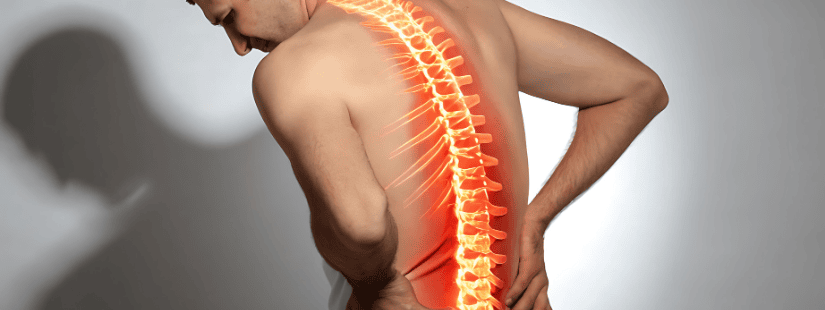 Back Pain Image